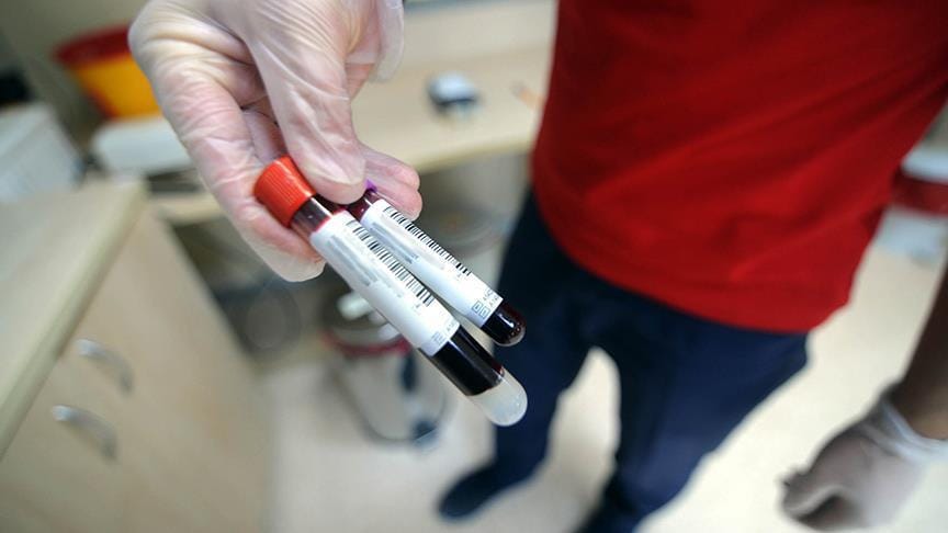 Kanseri semptomlarından önce teşhis edebilen test denendi