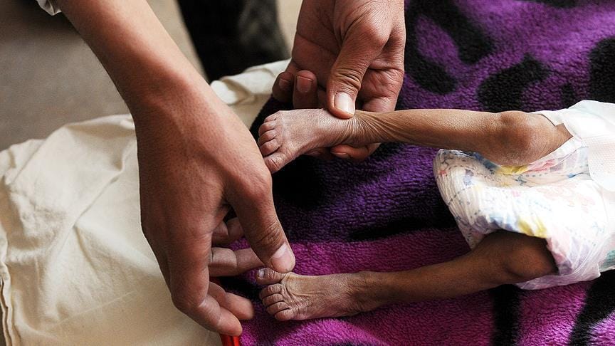 Husilerin engellemeleri nedeniyle Yemen’deki sağlık felaketinin boyutları artıyor