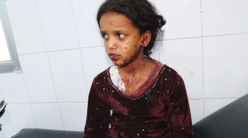 Husiler Yemen’de çocukları katlediyor