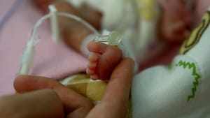 Dünyada her yıl 15 milyon bebek prematüre doğuyor