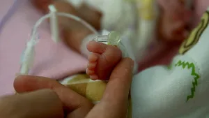 Dünyada her yıl 15 milyon bebek prematüre doğuyor